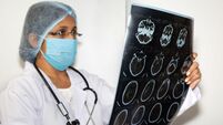 Indian female neurologist examine a brain CT scan plate at a healthcare clinic